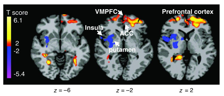 brain non obese group