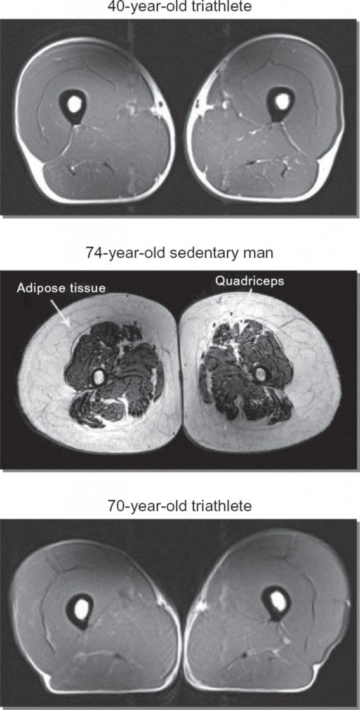 sedentary-vs-athlete-muscle-mass.jpg