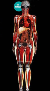slim woman